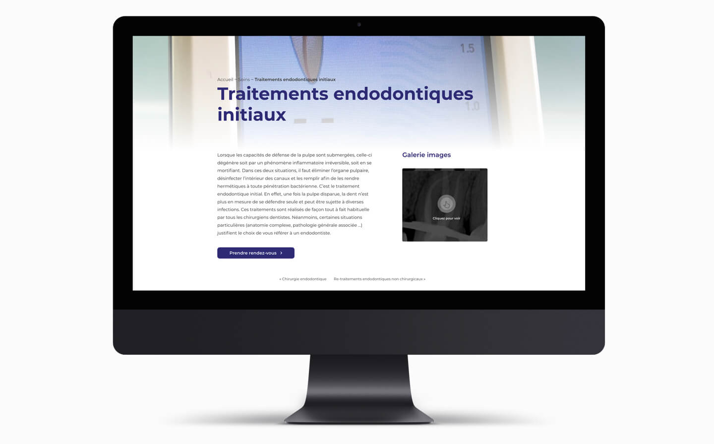 soins endodontiste site internet wordpress bordeaux clinique dentaire